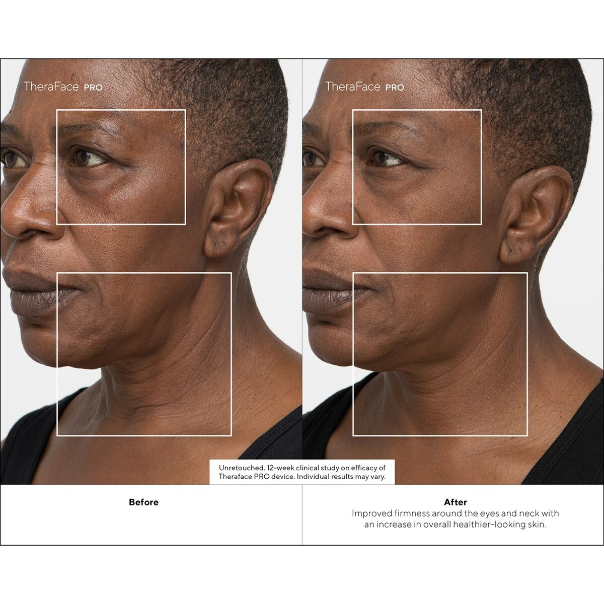 V4H24968A7E94E9DF67B31BD54103E15105R4939059P9