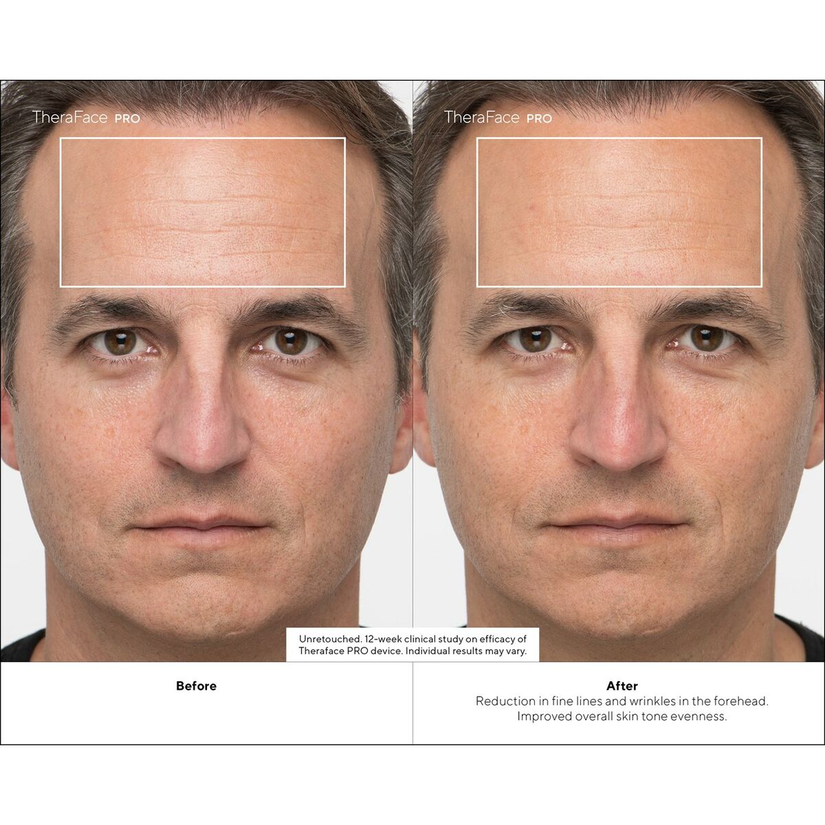 V6HF4AAD1C52DF16820D85AF27229C01803R4939060P10